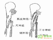 周围神经损伤