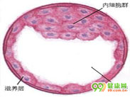 结核性阴道炎