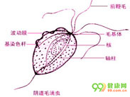 滴虫性阴道炎